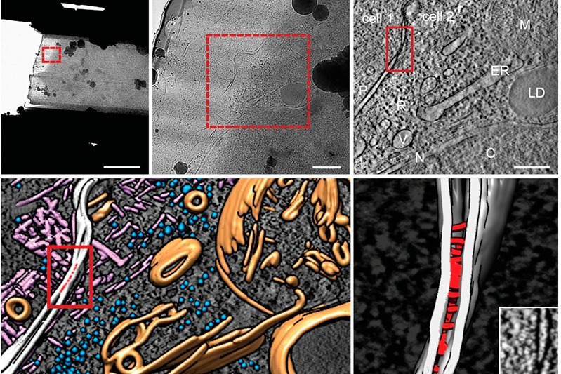 A plataforma de criomicroscopia eletrônica do Cenabio trabalha em escala nanométrica com imagens de alta definição de moléculas biológicas, tecidos, vírus e células. WhatsApp Image 2024 01 26 at 13.26.30